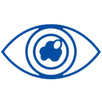Cataract Treatment